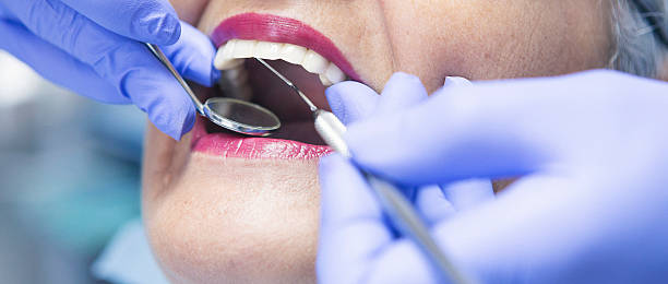 Best Emergency Dentist for Lost Fillings or Crowns in Pinewood Estates, TX